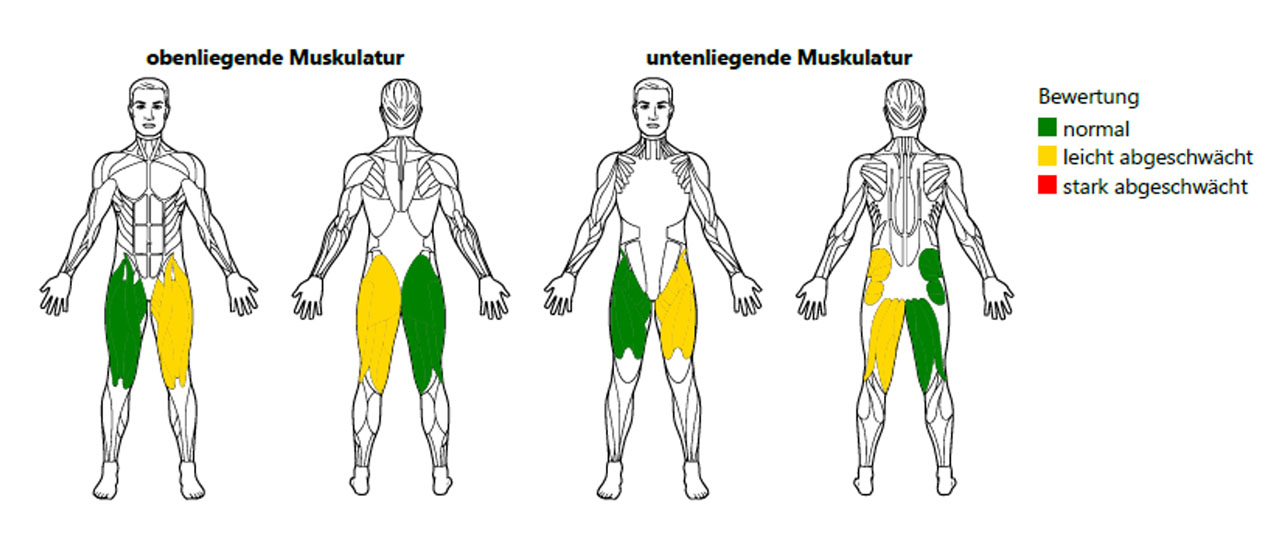 Beispielmessung Dysbalance