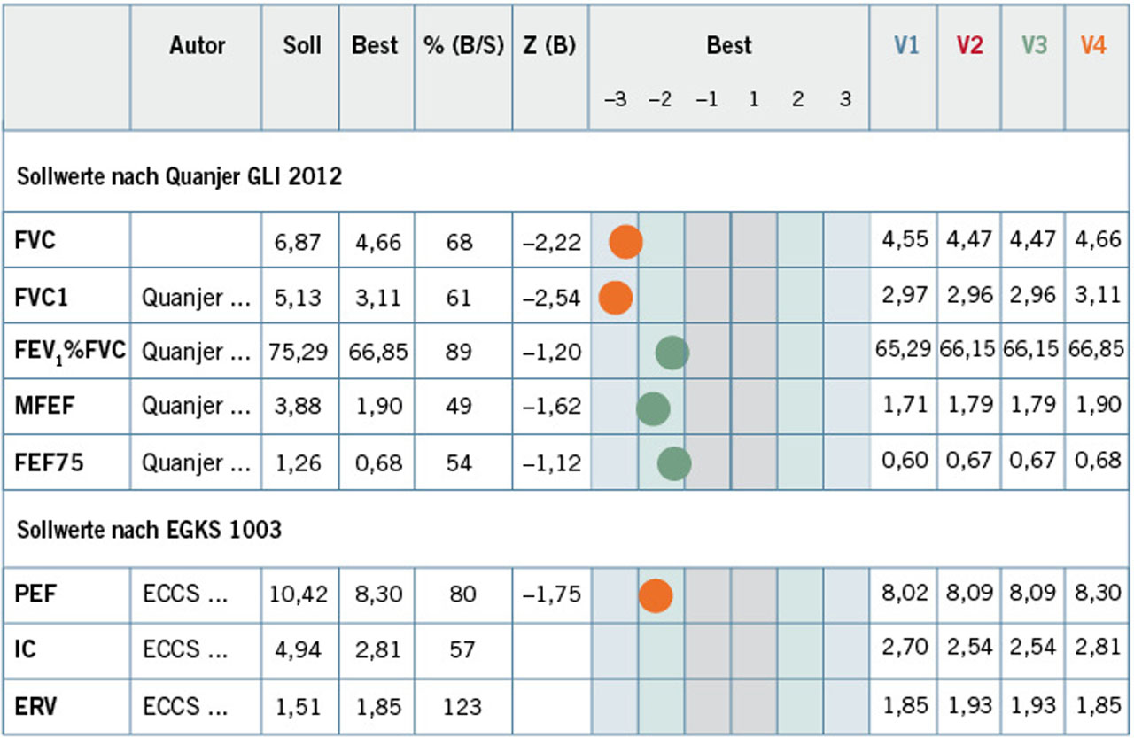 Tabelle Beispiel-Messung